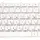 Клавіатура для ноутбука HP Pavilion DM4-1000, DV5-2000, DV5-2100 White, (No Frame) RU 2
